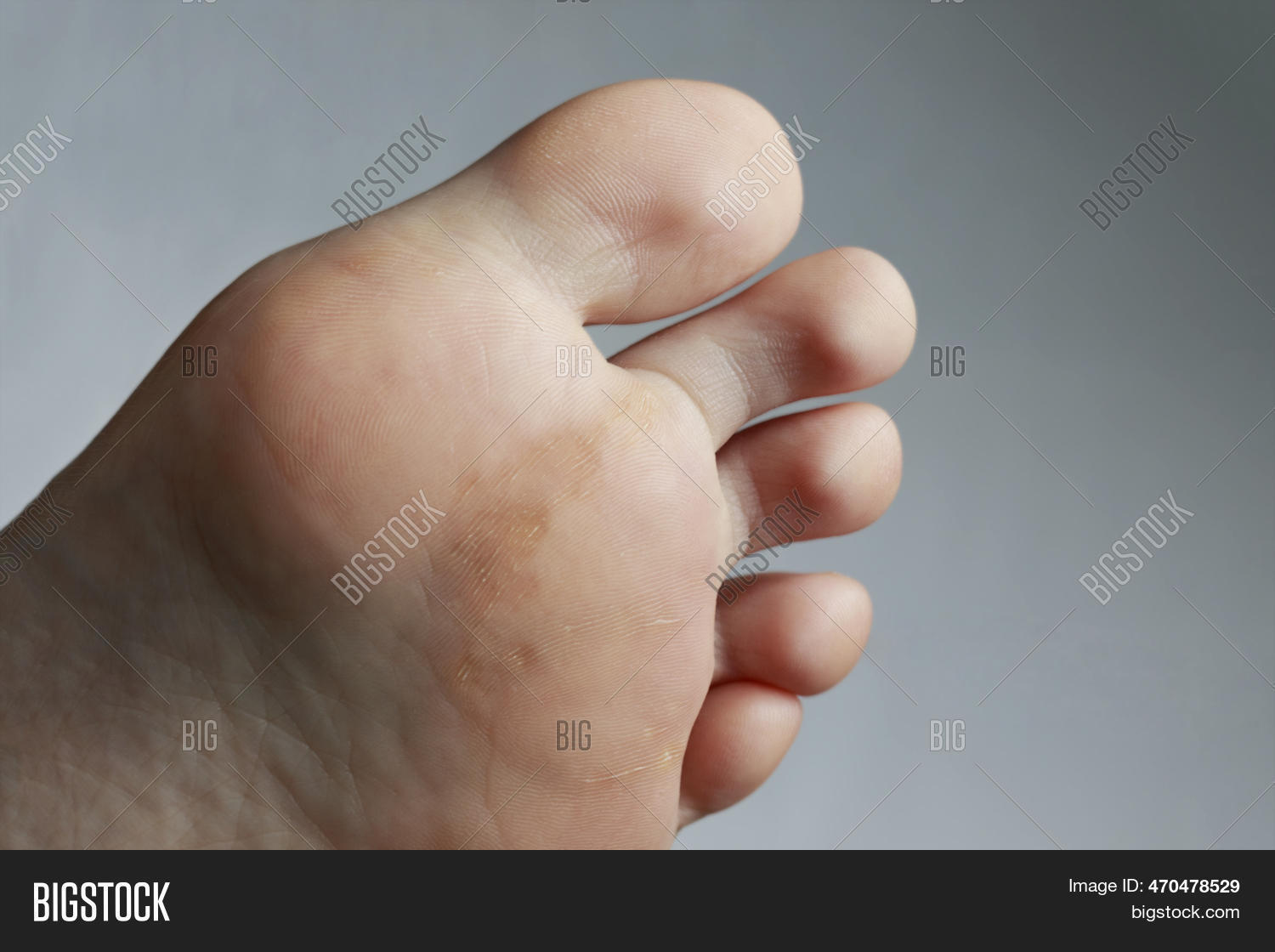 Human Foot Stomps Image & Photo (Free Trial) | Bigstock