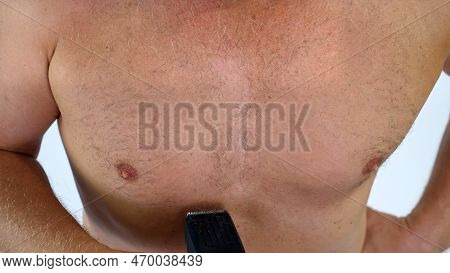Close-up Of A Very Hairy Man Haircut Body Hair On His, Male Chest By Himself With A Clipper, Electri