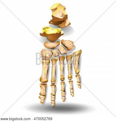 Anatomy Of The Foot - Toe Skeleton On White Background