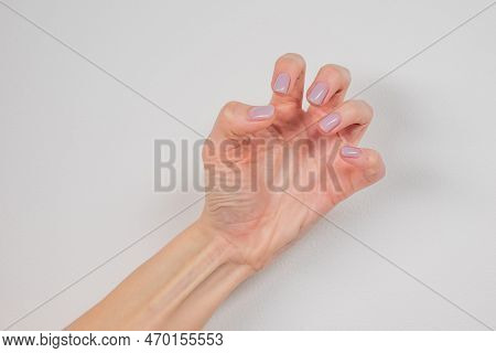Hands With Convulsions And Muscle Spasms, At The Time Of An Epileptic Seizure