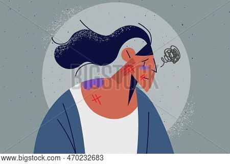 Unhappy Woman With Bruises And Scratches Suffer From Domestic Violence. Distressed Girl Struggle Wit