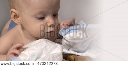 A Baby With A Hemangioma On His Neck Lies On A White Background. Banner With A Copy Space. Profile O
