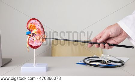 Doctor Nephrologist Pointing At Polycystic On A Kidney Mockup On His Desktop