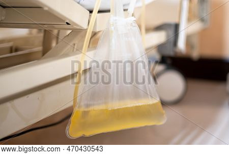 The Urine Or Pee Catheter Bag Hang Under Patient Bed In Hospital.