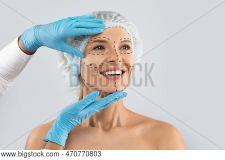 Cheerful Excited Woman With Pre Surgery Marks On Her Face