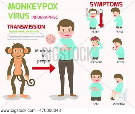 Monkeypox Virus Infographics Elements, Human Body With Rash. Symptoms Of The Disease, Swollen Lymph 