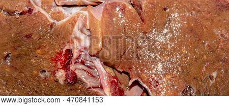 The Texture Of Beef Liver.fresh Raw Beef Liver Top View.beef Liver Background.beef Liver Top View.