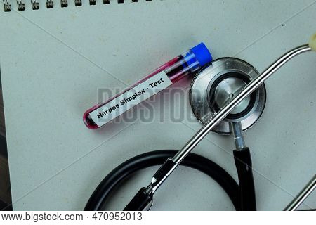 Concept Of Herper Simplex - Test With Blood Sample. Healthcare Or Medical Concept