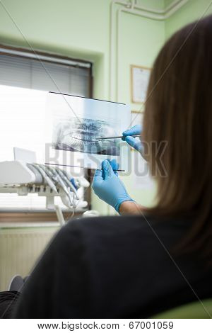 Dentist shows a patient x-ray of teeth
