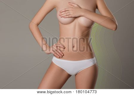 Women belly with the drawing arrows. The cellulite removal plan. White markings on young woman body preparing for plastic surgery. Concept of slimming liposuction strand lifting