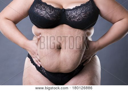 Woman with fat abdomen overweight female stomach stretch marks on belly closeup gray studio background