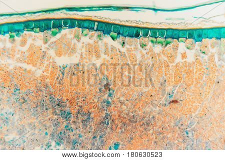 Medical Lab Prepared Microscopic- Weevil Rye