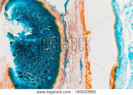 Medical Lab Prepared Microscopic- Weevil Rye