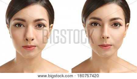 Young woman before and after rhinoplasty on white background. Plastic surgery concept