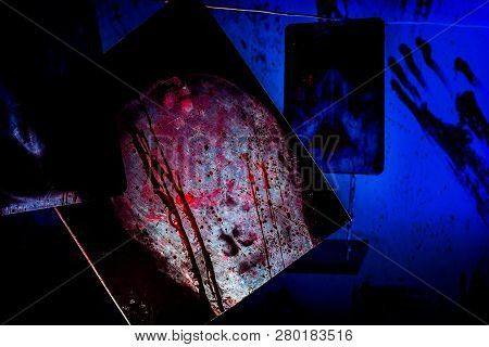 Bloody X-rays Of The Human Skull Hanging In The Terrible Dark Room Of Torture Maniac.