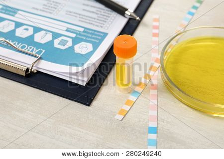 Container With Urine Sample For Analysis, Litmus Paper And Medical Report On Table In Laboratory