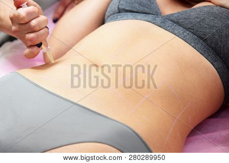 Beauty Injections In The Salon. The Procedure For Skin Tightening And Rejuvenation.