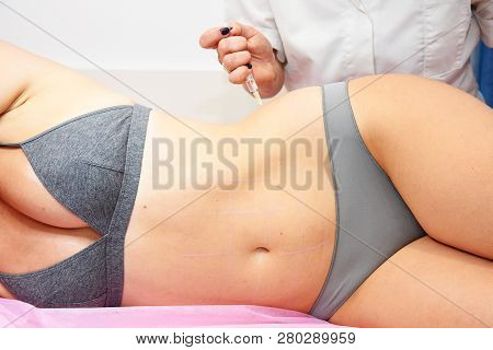Beauty Injections In The Salon. The Procedure For Skin Tightening And Rejuvenation.