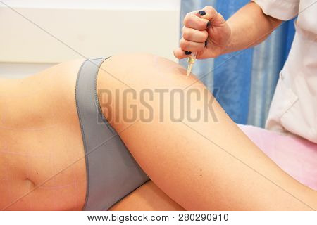 Beauty Injections In The Salon. The Procedure For Skin Tightening And Rejuvenation.