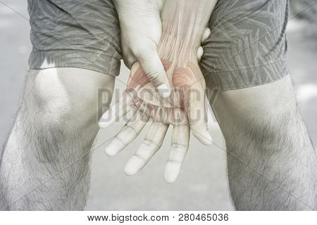 Hand Muscle Pain White Background Hand Injury