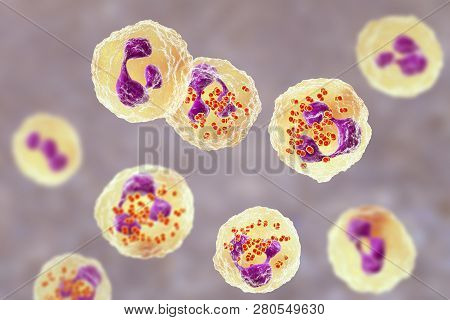 Bacteria Neisseria Gonorrhoeae Inside Neutrophils, Gonoccoccus, Diplococci That Cause Sexually Trans