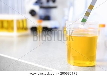 Putting Litmus Paper Into Container With Urine Sample On Table In Laboratory, Space For Text. Medica