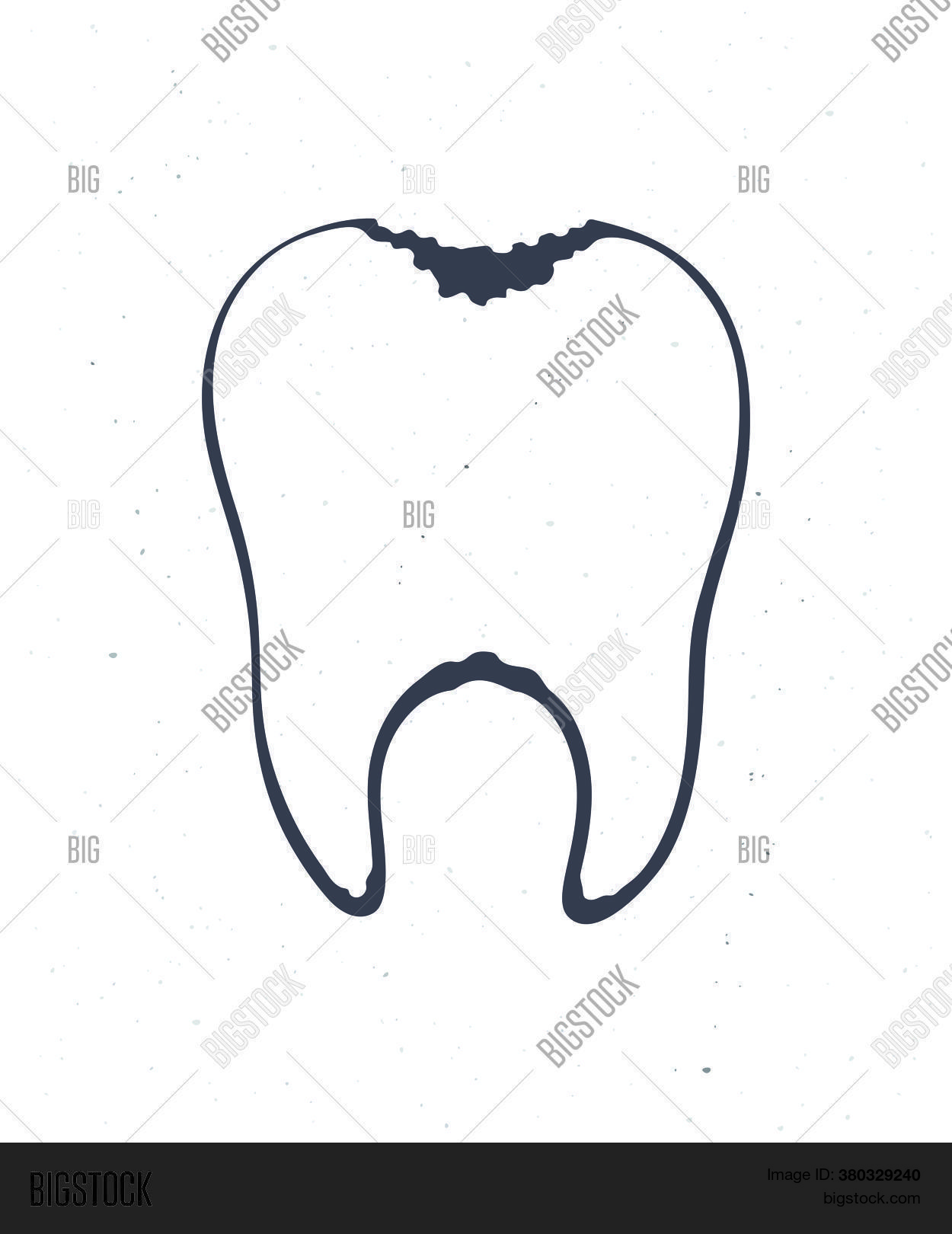 Unhealthy Human Tooth Vector & Photo (Free Trial) | Bigstock