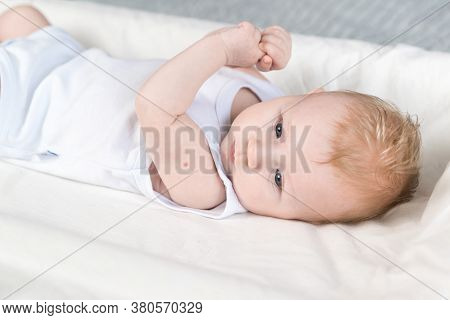 A Beautiful Newborn In A White Bodysuit With Traces Of Bcg Vaccination-the Tb Vaccine-on His Arm. Th