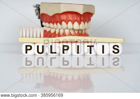 Medical, Dental Concept. The Text Is Written On The Cubes - Pulpitis. In The Background Is A Model O