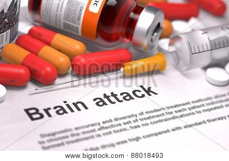 Brain Attack Diagnosis. Medical Concept.