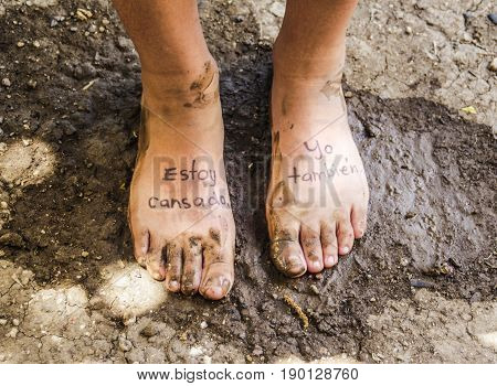 Pair Of Tired Feet