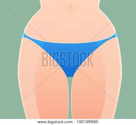 Vaginal discomfort from severe fungous infection, Cartoon