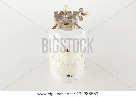 Occludator with grafted in it models of dentition