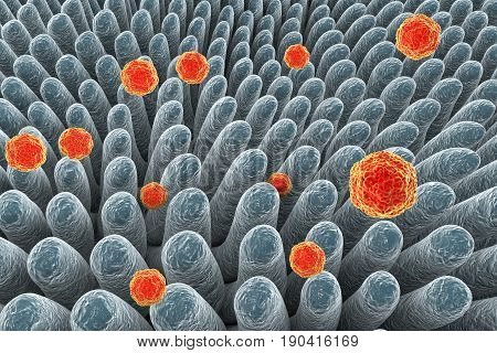 Hepatitis A viruses infecting intestine, 3D illustration