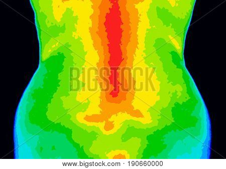 Thermographic image of the lower back sacrum of the upper body showing different temperature in a range of colors from blue showing cold to red showing hot which can indicate sacral inflammation.
