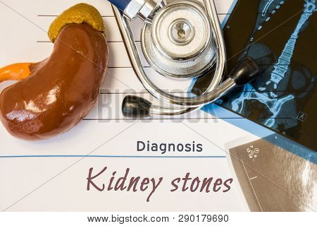 Diagnosis Kidney Stones Photo. Figure Of Kidney Lies Next To Inscription Of Diagnosis Of Kidney Ston