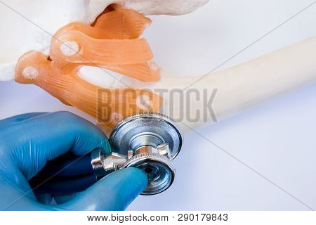 Doctor Checks With Stethoscope Sprain Or Tear Ligaments And Cartilage Of Joint Presence Of Fractures