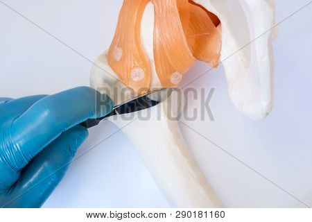 Orthopedic Or Trauma Surgery Concept Photo. Surgeon Holds Surgical Scalpel In Hand, Dressed In Glove