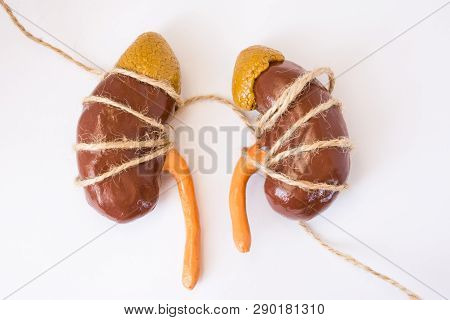 3d Anatomical Model Of Human Kidneys, Tied With Rope Lying On White Background. Idea For Kidney Cram