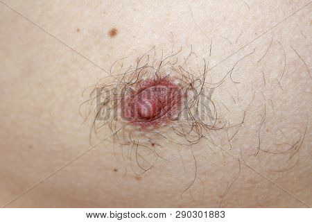 Male Hairy Nipple. Nipple With Hair. Easy Erotica And Humor. Without Epilation