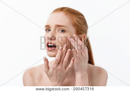 Young Caucsian Woman Squeezes Acne On The Face Of Beauty
