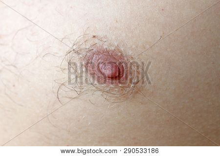 Male Hairy Nipple. Nipple With Hair. Easy Erotica And Humor. Without Epilation.
