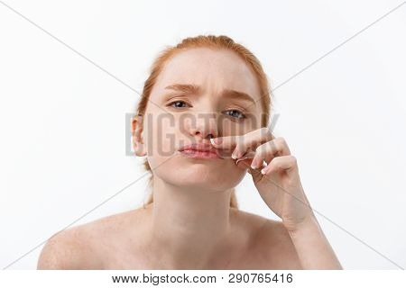 Young Caucsian Woman Squeezes Acne On The Face Of Beauty
