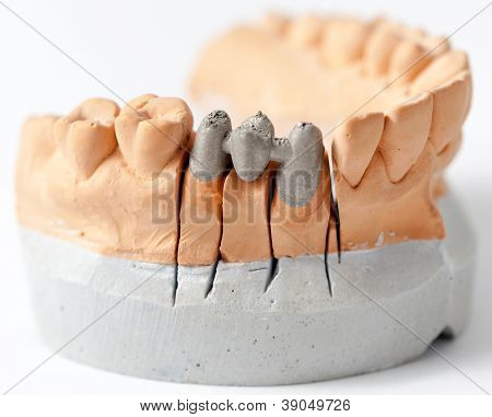 Prothetischen Dentallabor, technische Aufnahmen