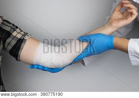 The Traumatologist Puts A Bandage On The Elbow Of The Female Patient. The Concept Of Help With Fract