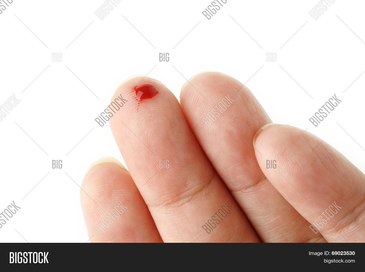 Bleeding Cut Finger Image & Photo (Free Trial) Bigstock
