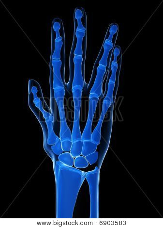 skeletal hand - arthritis