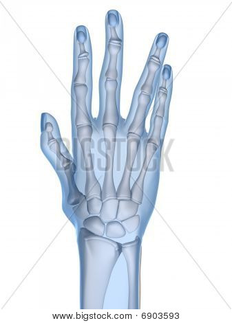 skeletal hand - arthritis