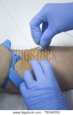 Nurse And Male Patient Blood Sample Donation