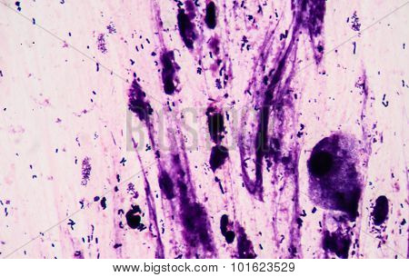 Gram Positive Bacilli Bacteria.